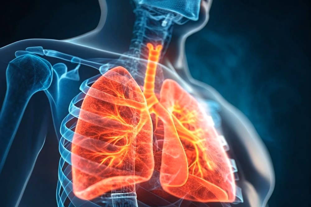 an image of a patient's lungs after oxygen therapy.