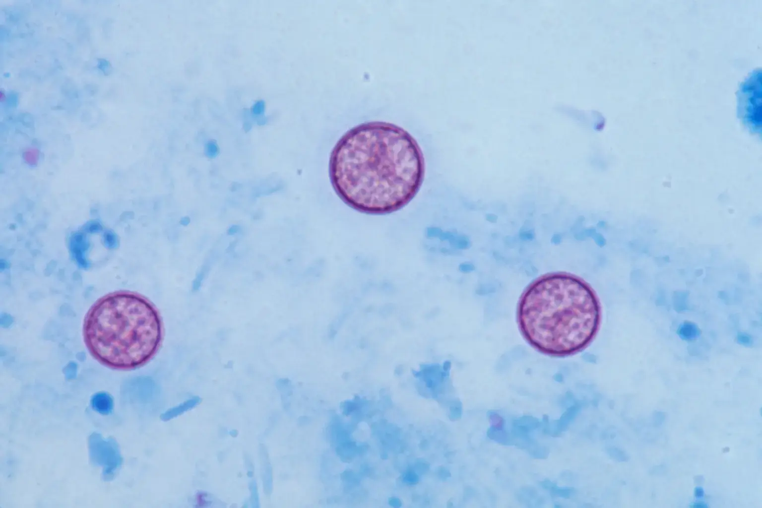 Three purple circular cells with granular interiors visible on a light blue microscope slide background.